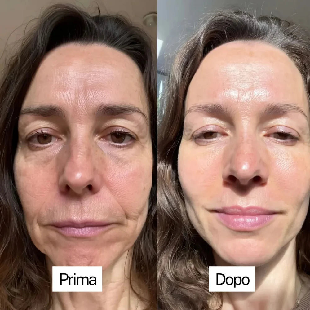 Maschera al Collagene con Acido Kojico e Curcuma